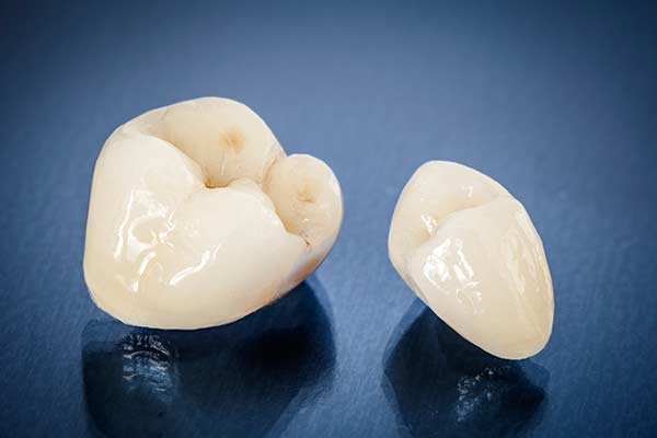 Restorative Dentistry at Sunshine Dentistry
