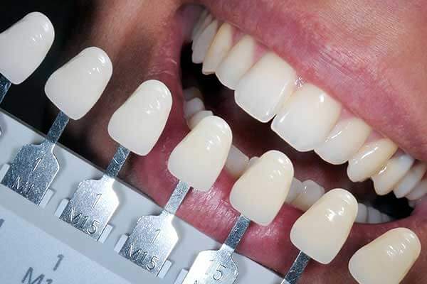 Restorative Dentistry at Sunshine Dentistry