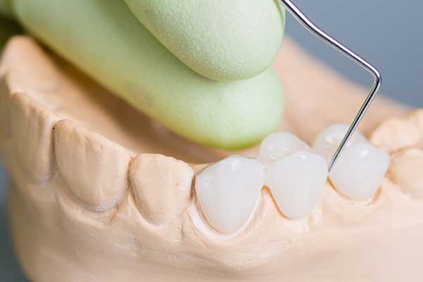 Restorative Dentistry at Sunshine Dentistry
